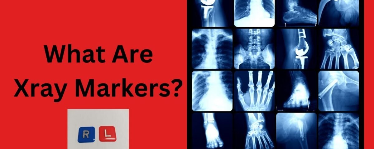 What are Xray Markers?